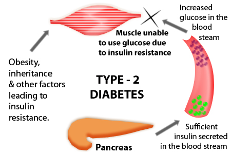 diabetes type2 BEAUFORT PERSONAL TRAINER: FIGHT DIABETES WITH EXERCISE ...