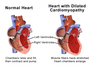 5 Ways Alcohol Affects Your Heart