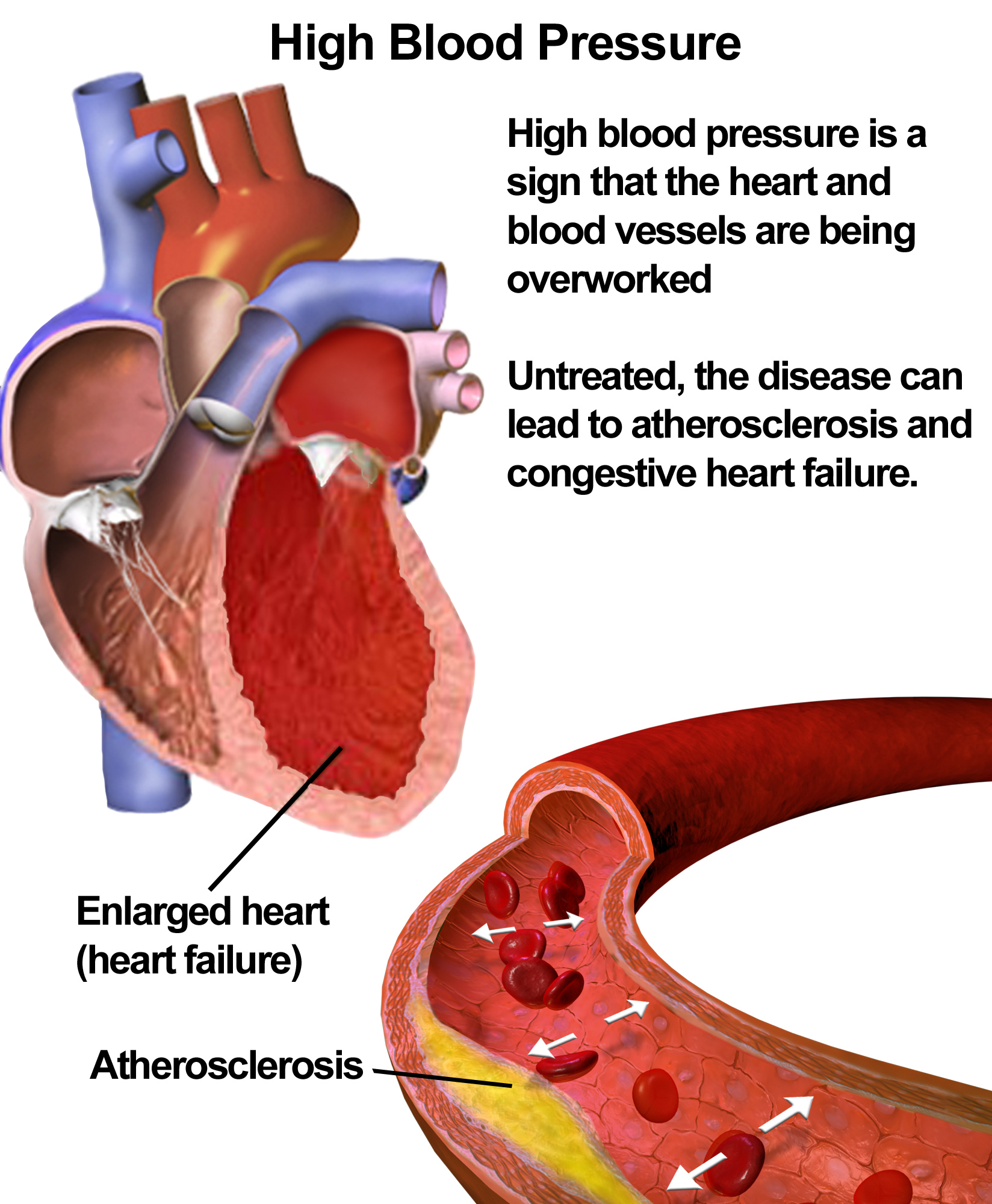 Heart Affected By Alcohol urine-ph-test