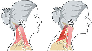 Neck Stretches | At Home Stretching Series