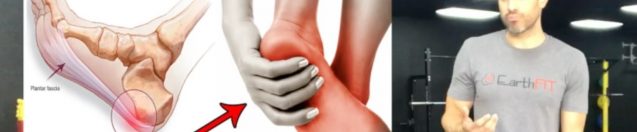 Plantar Fasciitis: Starter Routine